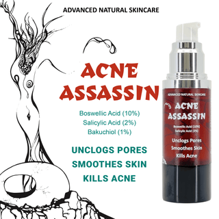 Acne Assassin Serum - Best Acne Treatment